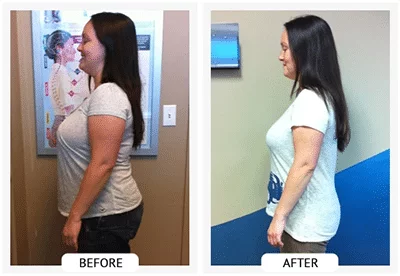 Chiropractic Athens GA ChiroThin Angela