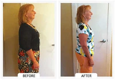 Chiropractic Athens GA ChiroThin Barb W