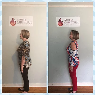 Chiropractic Athens GA ChiroThin Claudia