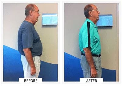 Chiropractic Athens GA ChiroThin Dan