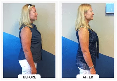 Chiropractic Athens GA ChiroThin Jeanie