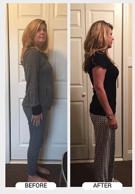 Chiropractic Athens GA ChiroThin Jill B
