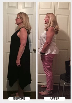 Chiropractic Athens GA ChiroThin Kathy N