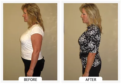 Chiropractic Athens GA ChiroThin Lana