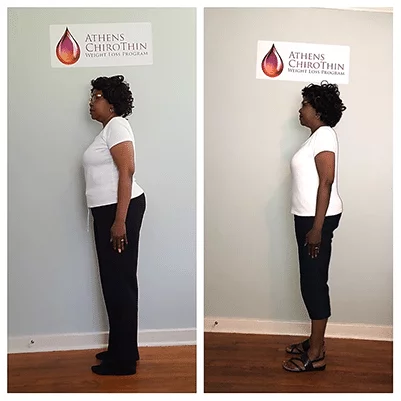 Chiropractic Athens GA ChiroThin Linda