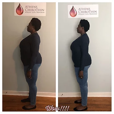 Chiropractic Athens GA ChiroThin Margret