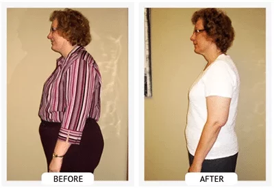 Chiropractic Athens GA ChiroThin Sherry