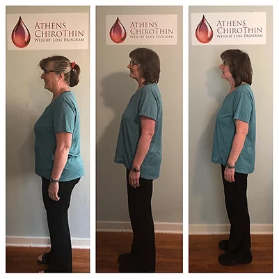 Chiropractic Athens GA ChiroThin